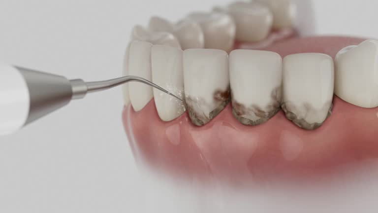 Trusted Teeth Cleaning And Checkup service in Glasgow, MO - Dentist Open Now